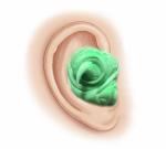 Earplugs Silicone Mold Putty 30 Shore A