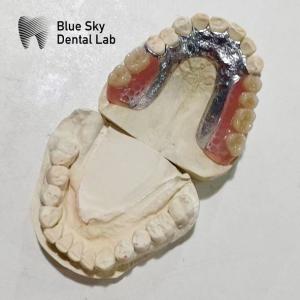 China Adjustable Denture Metal Framework Resin Teeth Rpd Metal Framework factory