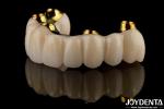 Precision Dental Titanium Bar Hybrid Zirconia Bridge Customization High