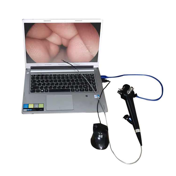 USB Hospital Surgical Instruments ODM OEM Endoscope Ureteroscopy One Scope Video Laryngoscope