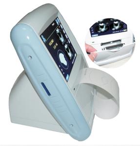 China Ultrasound bladder scanner Bladder volume ultrasound scanner factory