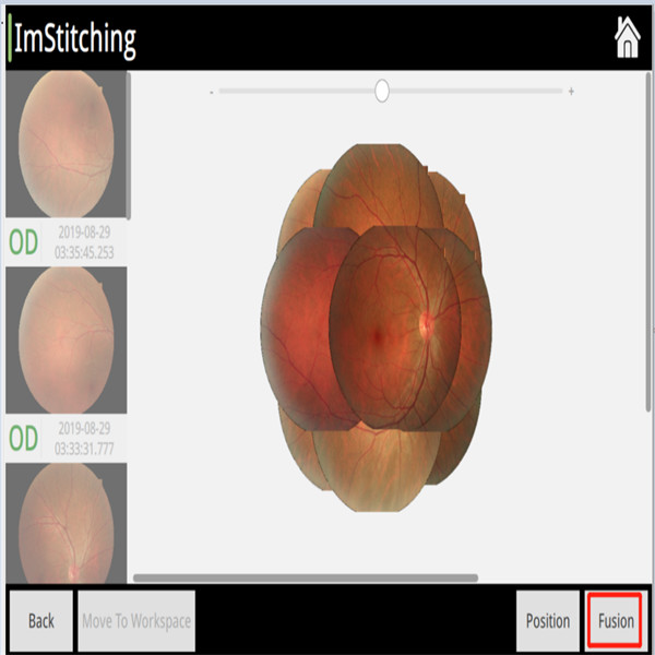Non Mydriatic Retinal Camera Automatic FFA Small Pupil Dual