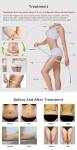 576 dots Slimming Machine Weight Loss Body Anti Cellulite Liposonixing Lipo