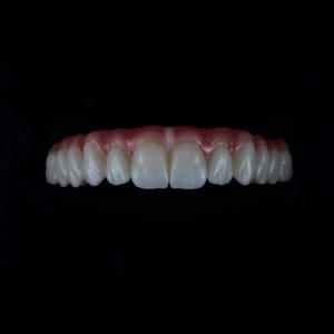 China Full Coutour Arch Zirconia Fixed Dentures Crown Biocompatible Material factory