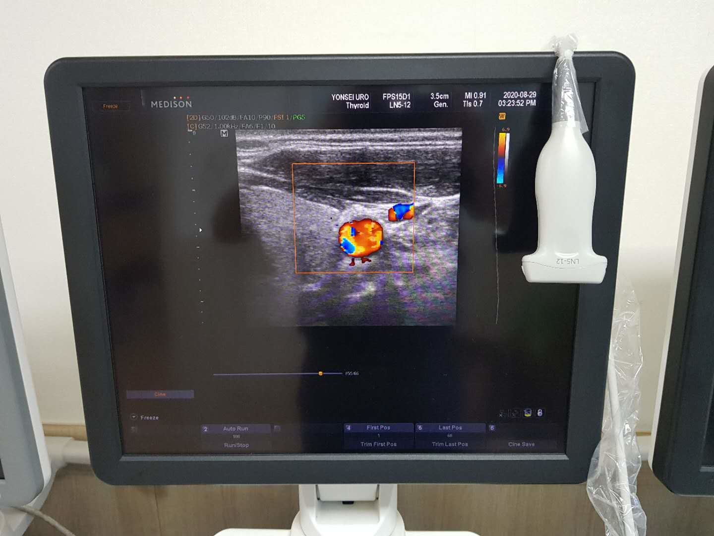 Abdomen Convex Linear Ultrasonic Probe Samsung Medison LN5-12
