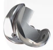 China RSK PS Femoral Condyle Revision Knee Joint Prosthesis Replacement factory