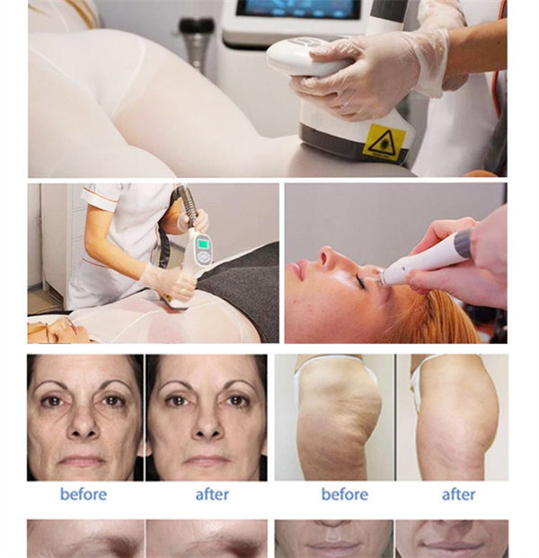 110V To 240V Cavitation Body Slimming Machine Sculpting Slimming