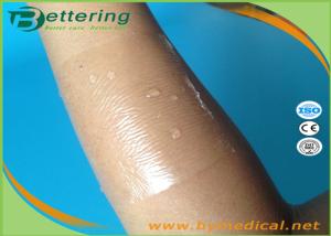 China Waterproof pu film drape roll transparent medical dressing wound care surgical dressings bandage factory
