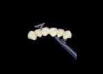 Biocompatible Porcelain Fused To Metal Crown High Durability For Enhanced