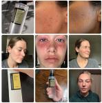 Hydrating Moisturizing Face Serum Snail Mucin 96% Power Repairing Essence 3.38