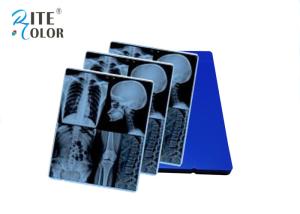 China Blue Laser X Ray Film Digital X Ray Film For CT MR Equipment Image Output factory