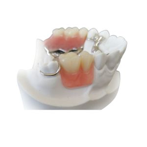 Custom Smooth Surface CAD CAM PFM Crown Bridge High Definition