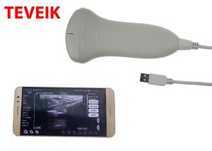 China CE USB Ultrasound Machine Laptop Tablet Ultrasound Scanner Convex Probe factory