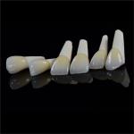 Dental Lab Teeth Feldspathic Porcelain Veneers Custom Shaped