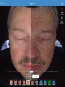 China Face Skin Analyzer For Clinic Face Care Test , Facial Skin Analyzer factory
