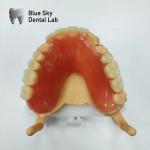 Restoration Full Upper Acrylic Denture Blue Sky Removable Acrylic Denture