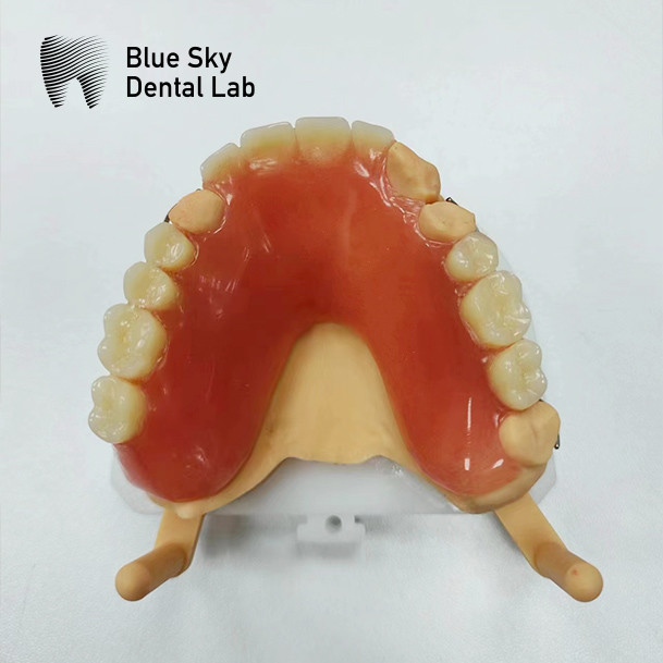 Missing Teeth Acrylic full Denture Restoration Acrylic Complete Denture