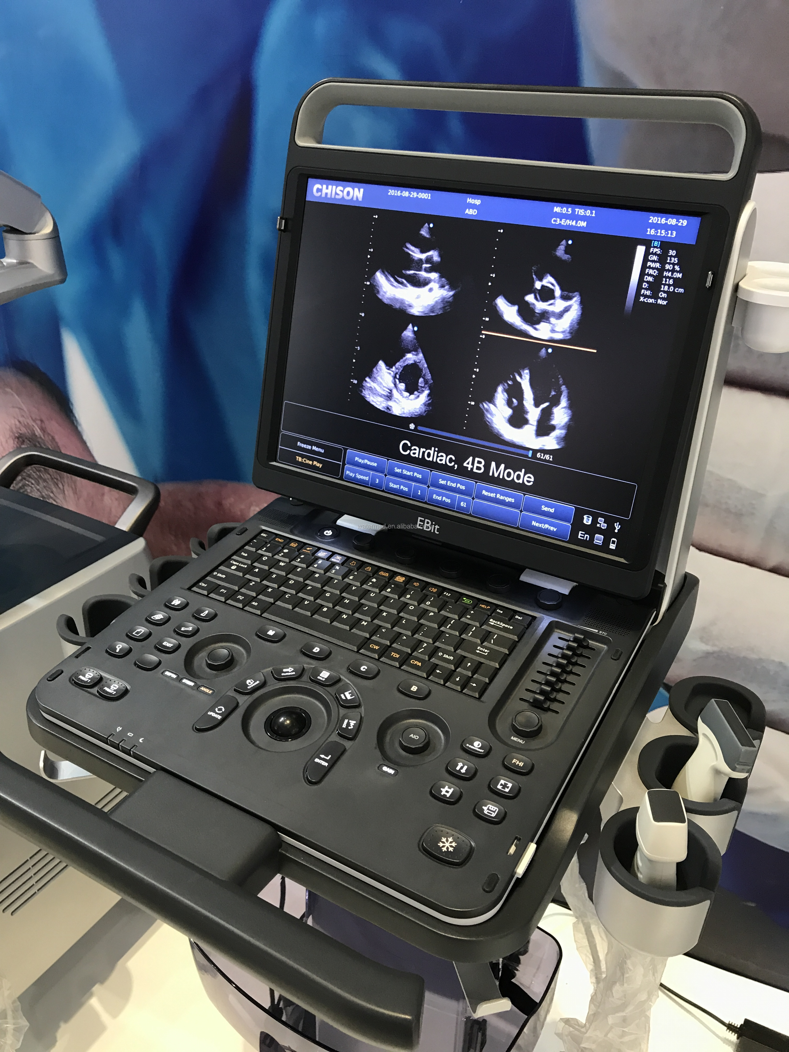 Portable 3D 4D Color Doppler USG&Sonoscape S9