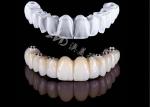 Affordable Precise Full Zirconia Crown , High Strength Zirconia Dental Crown