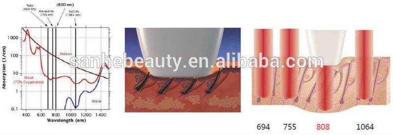 + Laser diode 808nm/diode laser 808nm hair removal