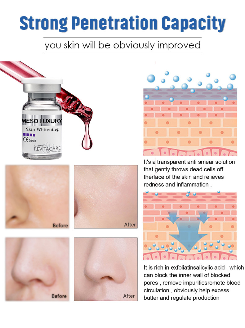 LUXURY Meso Serum Microneedling Instantly Absorbed Skin Whitening Essence 10ML