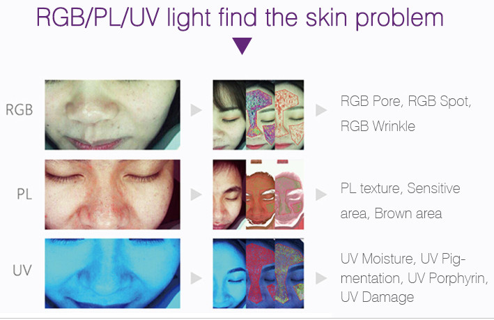 3d Skin Analyzer Automatic Skin Diagnosis Face Scanner Camera