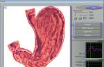 Full Body 3d Nls Health Analyzer , Magnetic Resonance Imaging