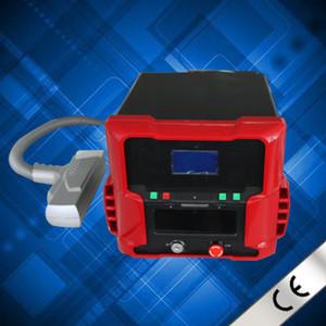 Q Switched ND YAG Laser for Tattoo Removal; Pigment Removal