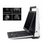 Hot Slaes Ecografo Portatil Sonoscape E2 Ultrasonido Portatil