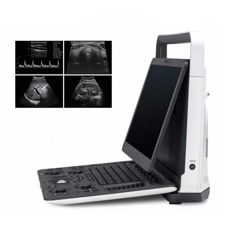 China Hot Slaes Ecografo Portatil Sonoscape E2 Ultrasonido Portatil factory