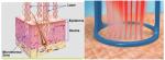 Multifunction medical laser co2 fractional/fractional co2 laser/co2 fractional