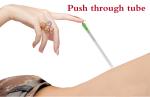 0.16mm Silver Intradermal Acupuncture Needles For Pain Relief