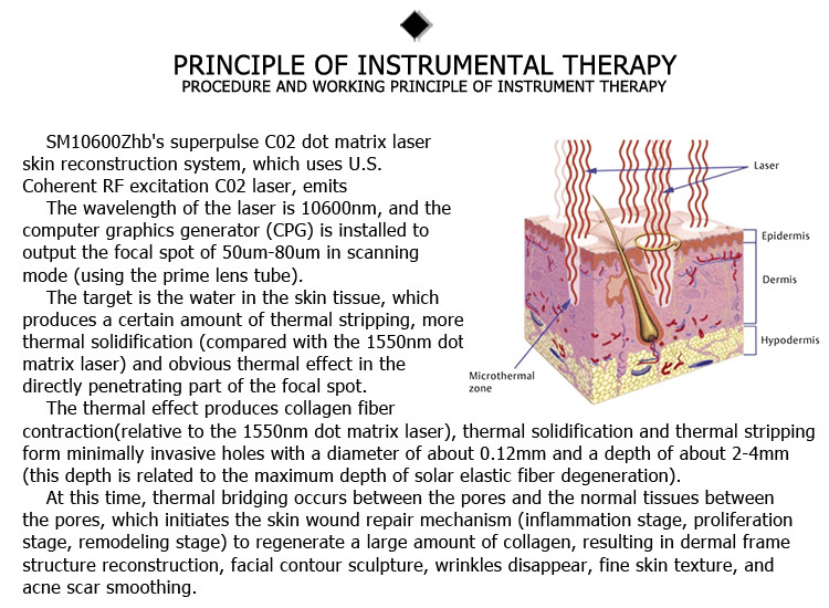 Professional 2021 newest 1-100ms pulse duration 30w fractional co2 laser treatment for acne scars