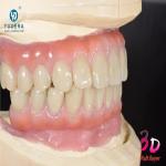 1200MPa HT Dental Zirconia Block Zirconium Oxide High Flexural Strength