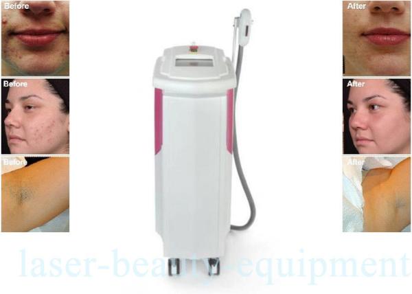 Shr IPL Intense Pulsed Light Laser Hair Removal Equipment 2500W Power For Under