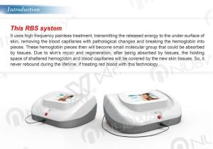 China High frequency spider veins removal beauty equipment factory