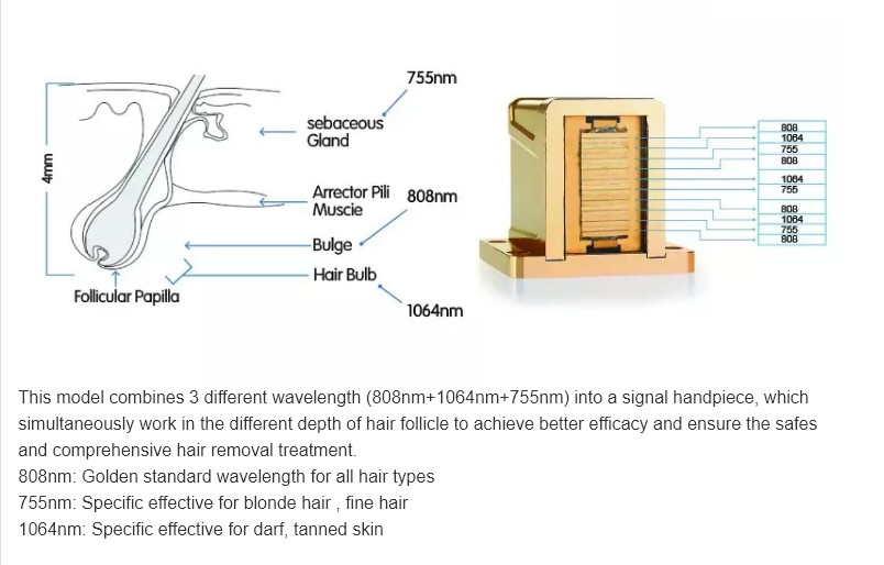 new price 755nm 808nm 1064nm diode alexandrite laser hair removal machine