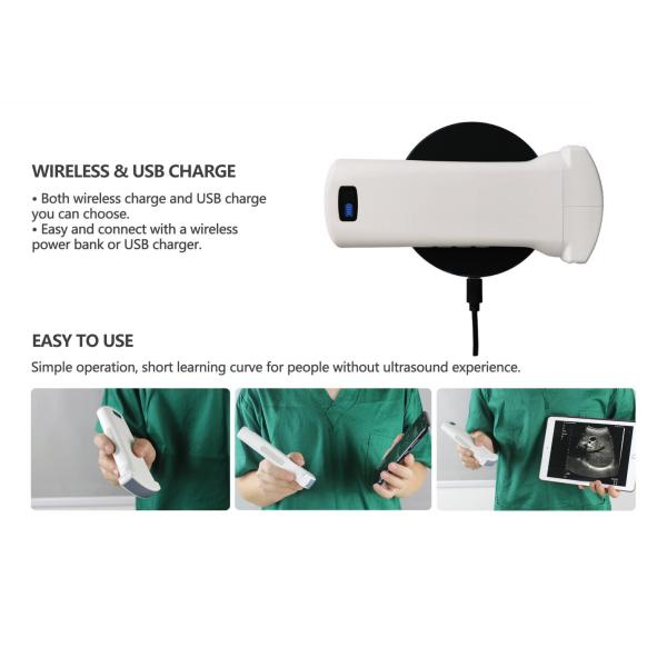 USB Convex Ultrasound Transducer Wireless Convex Array Ultrasound Probe for OB/GYN Lung Urology Application