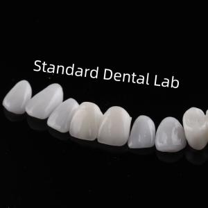 China High Esthetic Teeth Emax Laminate Veneers Incisal Translucency factory