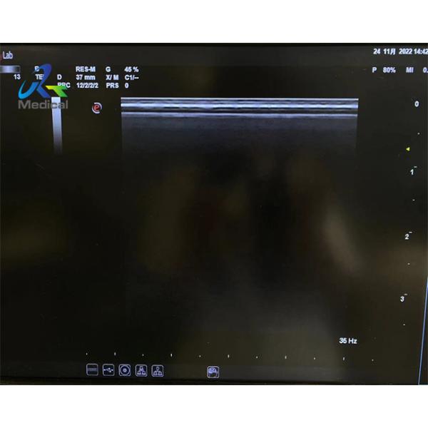Biosound Biosound SL1543 Linear Array Ultrasound Probe Repair Replace Lens And