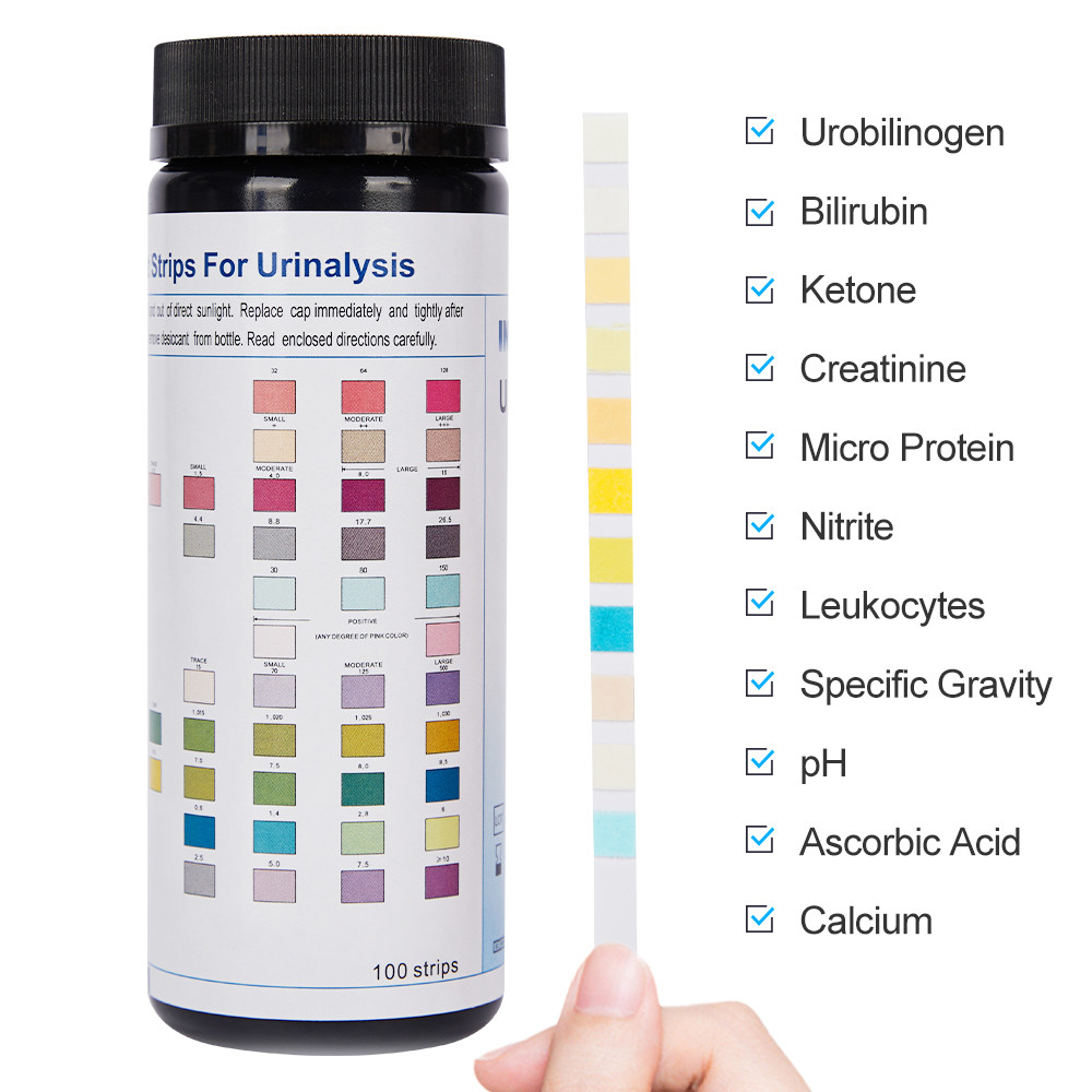 Reagent Urinalysis Test Strips To Nitrite / Leukocytes / Urobilinogen / Ketone / Bilirubin / Sg / Ph / Cal