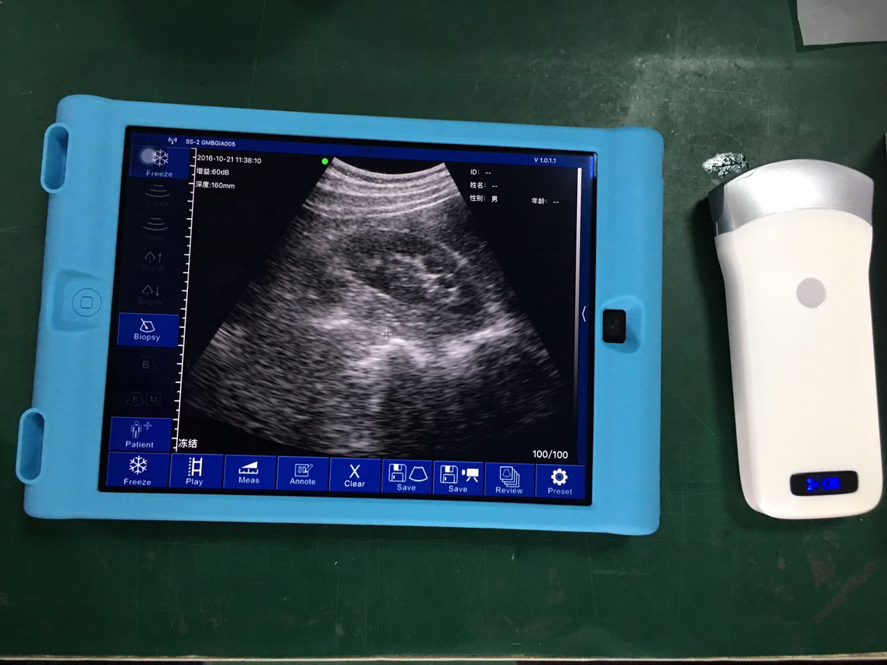 High Quality Medical Ultrasound Handheld Wireless Mini Color Doppler Ultrasound Scanner