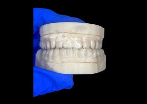 China Clear Invisible Retainer Orthodontic Appliance Advanced Thermoplastic Materials Crafted Custom Fit factory