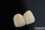 1350-1450°C Sintering Temperature Layered Zirconia For Superior Biocompatibility