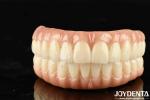 Natural-looking Aesthetics Zirconia Hybrid Bridge With High Durability And