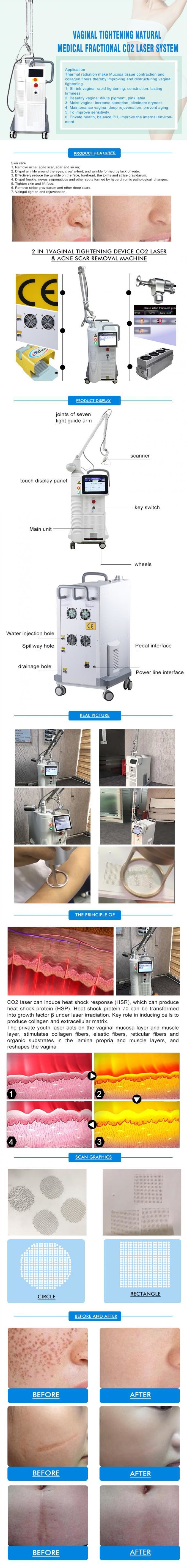 Ultra Pulse / Single Pulse RF Fractional CO2 Laser Multi Language With 7 Joints Arm
