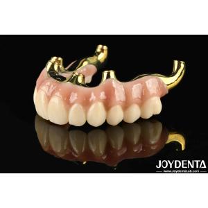 China Restoring Chewing Function Ti-Bar Zirconia Hybrid Bridge With High Biocompatibility And Precise Fit on sale