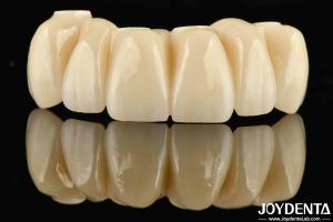 China Dental Restoration Ti-Base Zirconia Hybrid Bridge Natural Looking Precise Fit factory
