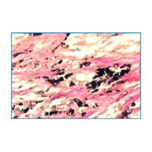 Melanin Stain (Ferrous sulfate staining method)