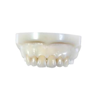 China Zirconia All-Ceramic Teeth Crowns & Bridges on sale